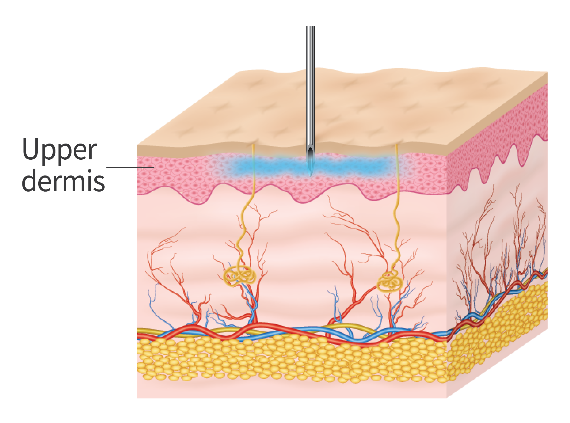 Superficial stimulator - 19 Needles 0.5mm/1.0mm (20EA)